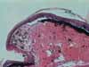 Гистология ocelli